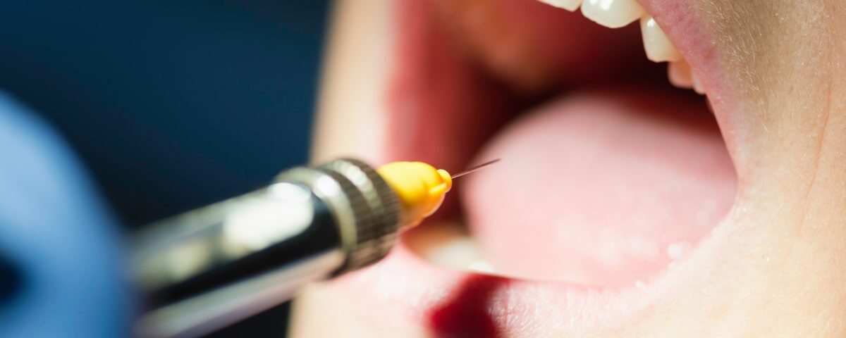 Cracked Tooth Repair Cost in Avondale, AZ