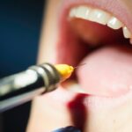 Cracked Tooth Repair Cost in Avondale, AZ