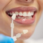 How Much Do Dental Veneers Cost in Avondale, AZ
