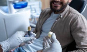 How Much is the Success Rate of Dental Implants