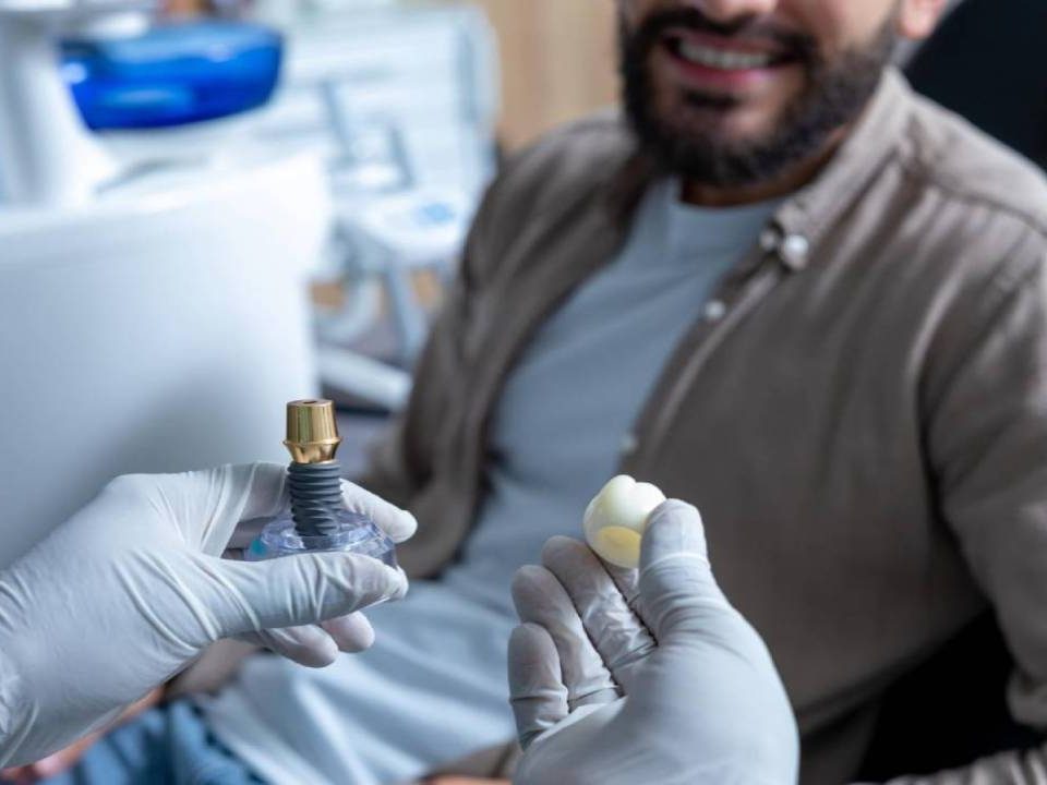 How Much is the Success Rate of Dental Implants