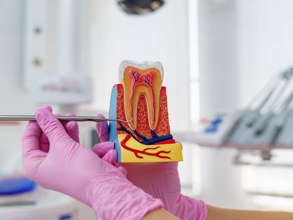 What is the Success Rate of Root Canal Treatments