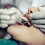 How Much is the Oral Surgery Cost in Avondale, AZ