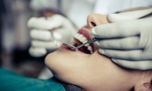 How Much is the Oral Surgery Cost in Avondale, AZ