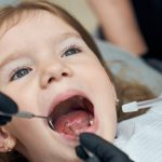 Should You Fill Cavities in Baby Teeth