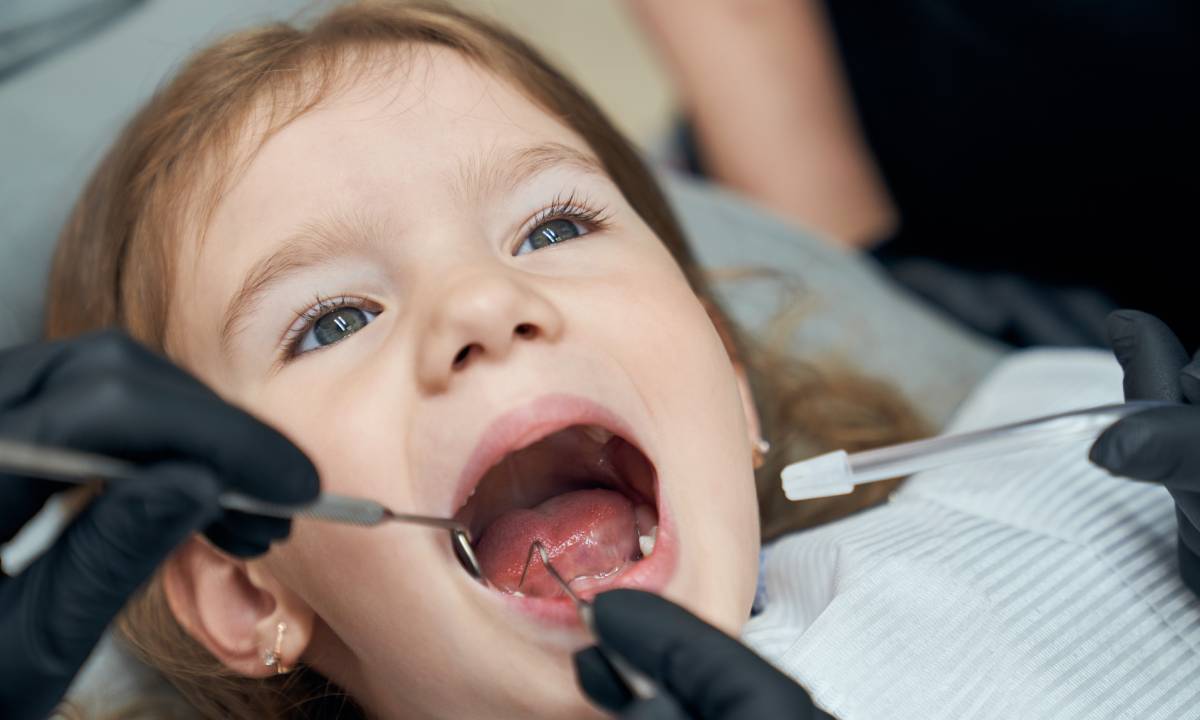 Should You Fill Cavities in Baby Teeth