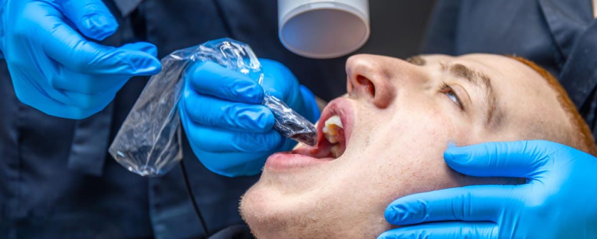 What Do Dentists Use to Fill Cavities?