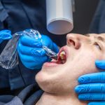 What Do Dentists Use to Fill Cavities?