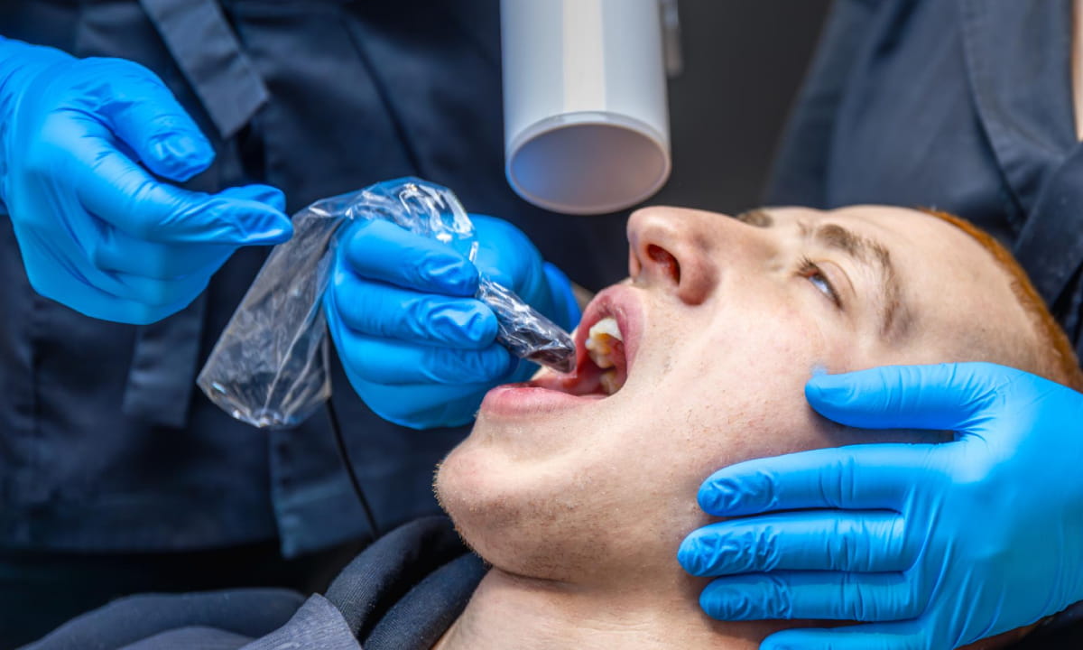 What Do Dentists Use to Fill Cavities?