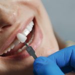 How Strong are Porcelain Crowns