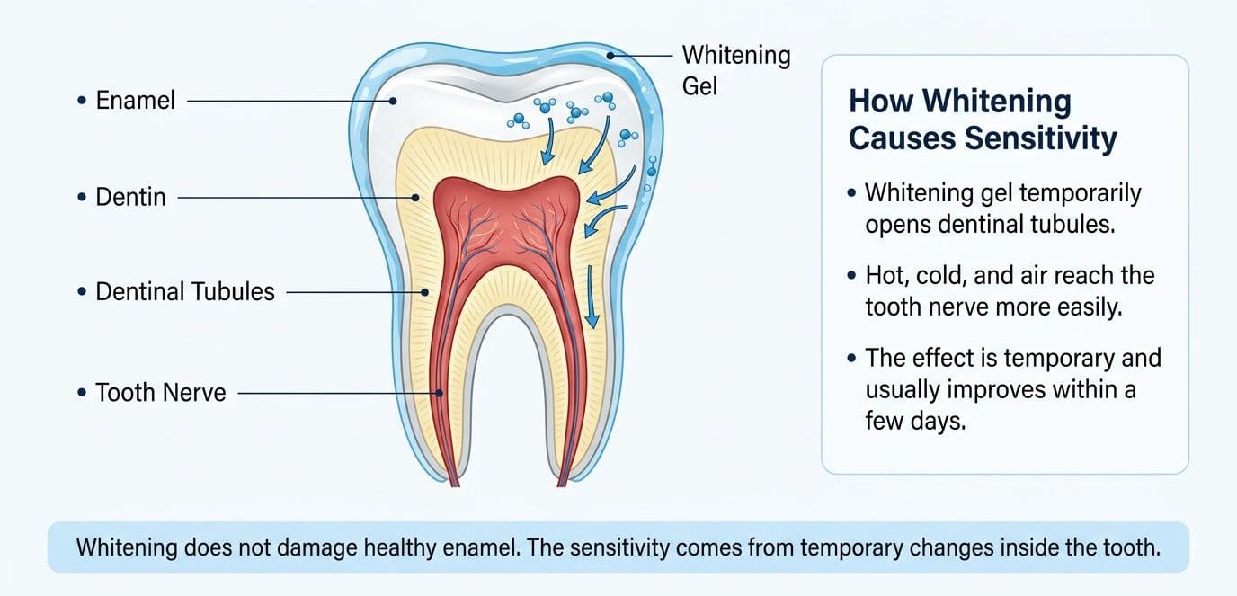 Why Do Teeth Get Sensitive After Whitening